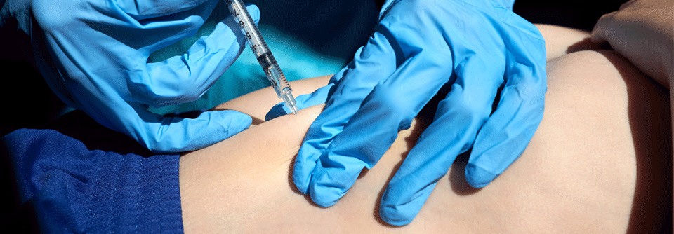 Verkürzte Antikoagulation nach venöser Thromboembolie bei Kindern und Jugendlichen Erhalten Kinder und Jugendliche nach eienr venösen Thromboembolie niedermolekulares Heparin, kann eine sechswöchige Behandlung genügen.