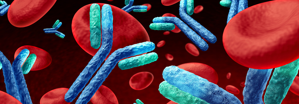 Trotz frühzeitiger und aggressiver Behandlung ist die Mortalität beim katastrophalen Antiphospholipidsyndrom erhöht.
