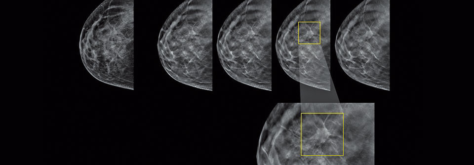 In der 3D-Darstellung lassen sich Knoten leichter identifizieren.