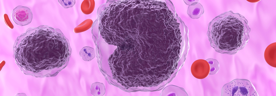 Die Ergebniss der Phase-I-Studie zur Behandlung des Non-Hodgkin-Lymphoms mit Odronextamab sprechen für weitere Studien der Phasen 2 und 3.