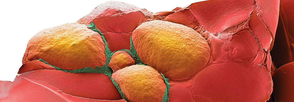 Ein etwas anderer Blick auf die Schilddrüse. Dieses rasterelektronenmikroskopische Bild zeigt diverse Follikel (orange) mit den hormonbildenden Epithelzellen (grün) und Bindegewebe (rot).