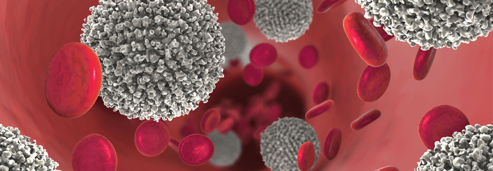 Zu den charakteristischen und relativ häufigen
genetischen Aberrationen bei AML und MDS zählen
Mutationen in den Genen SF3B1 und U2AF1.