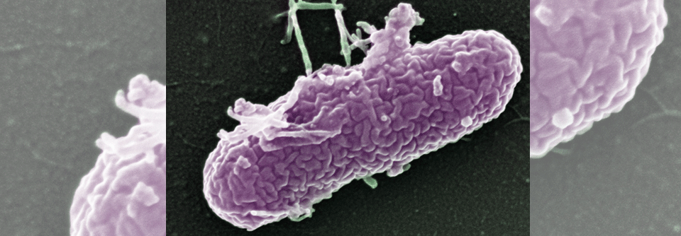 Ein Burkholderia-cepacia-Bakterium im gefärbten raster-­elektronenmikrosko­pischen Bild. 