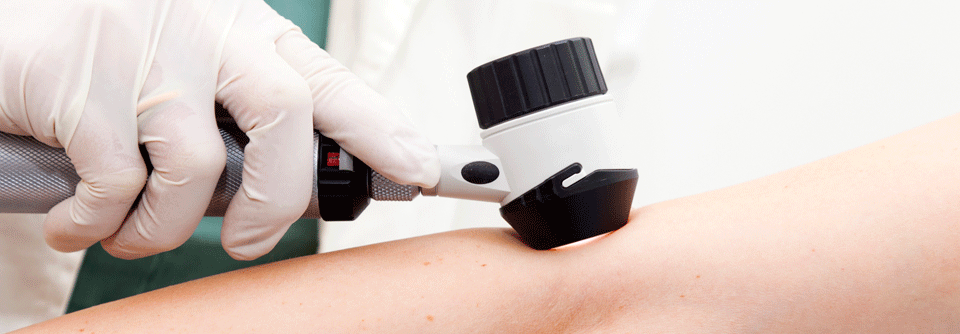 Das Hautkrebs-Screening ist mittlerweile in vielen Ländern etabliert.