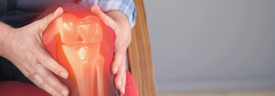 Arthrosetherapie ernährungsmedizinisch unterstützen Das Fortschreiten einer Arthrose kann durch eine ausgewogene Ernährung und regelmäßige Bewegung positiv beeinflusst werden.