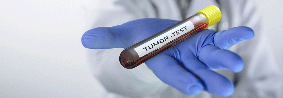 Blutbasierte Tests zur Darmkrebsfrüherkennung kommen deutlich besser an.
