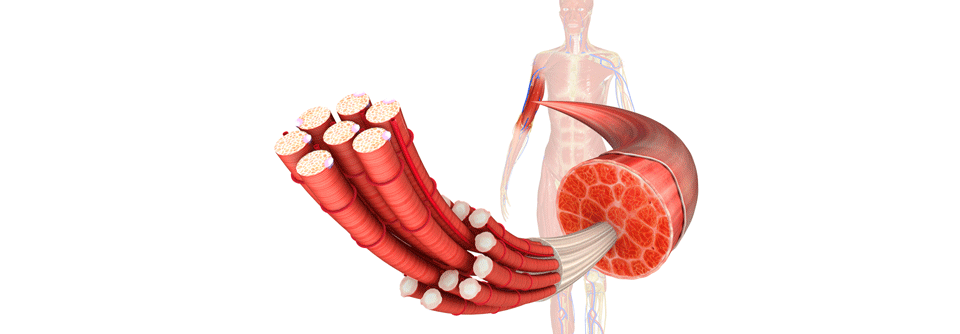 Charakteristisch für Myositiden ist die Muskelschwäche bei ungestörter Sensibilität und erhaltenen Eigenreflexen.