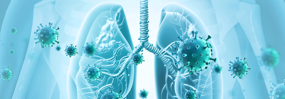 Das NSCLC metastasiert häufig in Lymphknoten, ipsi- oder kontralateral in Lunge, Skelett, Leber, Nebenniere und ZNS.