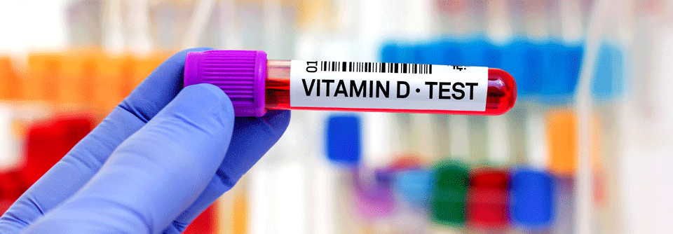 Vitamin-D-Tests sind in den meisten Fällen nicht indiziert, werden aber trotzdem übermäßig oft durchgeführt.