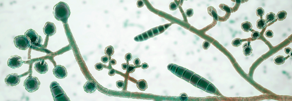 Nicht so einheitlich wie man denkt: Im Pilzgeflecht von T. mentagrophytes findet man u.a. zigarrenförmige Makrokonidien, Mikrokonidien, die wie Trauben an Konidophoren hängen, Chlamydospren und Spiralhyphen.