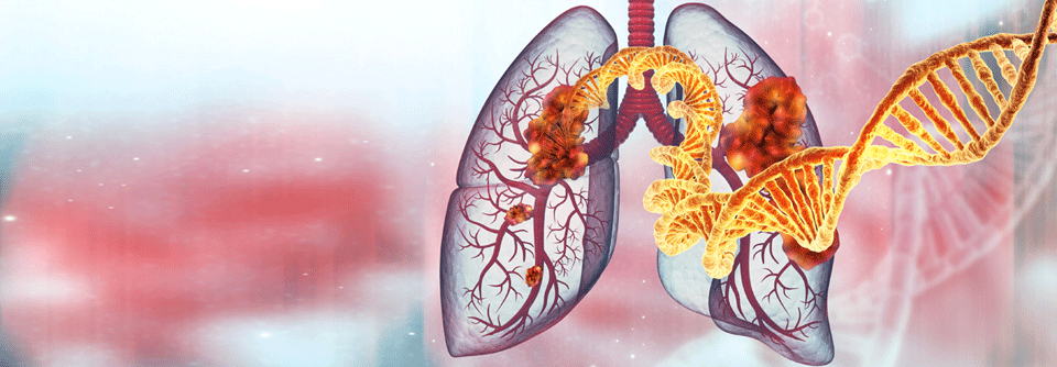 Studien über das NSCLC mit METex14-Skipping-Mutationen sind bisher noch recht rar.