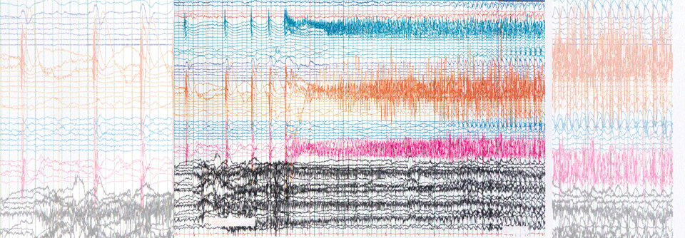 Ein besonders hohes Rückfallrisiko besteht in den ersten zwei Jahren nach dem Absetzen von Antiepileptika.