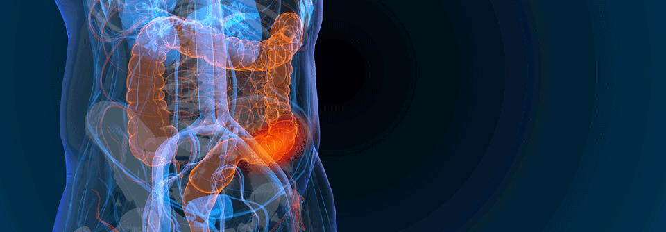 In der FRESCO-2 Studie wurde festgestellt, dass
der hochselektive orale Tyrosinkinase-Inhibitor das Gesamtüberleben von Patient:innen mit mCRC erhöht.