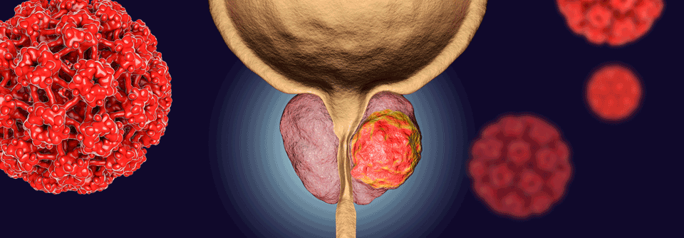 In die Studie eingeschlossen waren intensiv vorbehandelte Erkrankte mit mCRPC im medianen Alter von 74,5 Jahren.