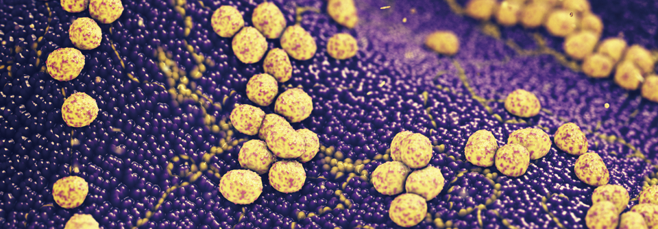 Staph. aureus ver­ursacht nicht immer Infektionen. Er kommt auch auf gesunder Haut vor.