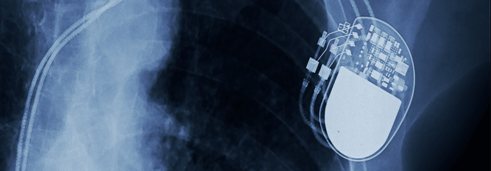 Während der durchschnittlichen Beobachtungszeit von knapp vier Jahren beendeten die Kardioverter-Defibrillatoren (ICD) bei 23 Sportlern 42 Episoden von Kammerflimmern. 