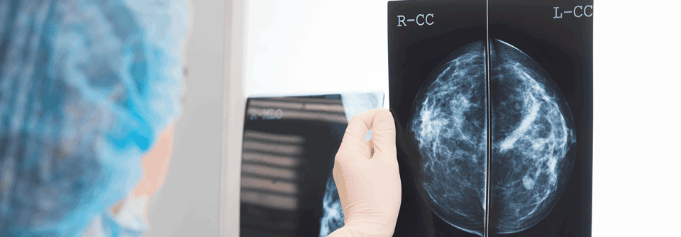 Die TROPiCS-02-Studie prüft das Antikörper-Wirkstoff-Konjugat bei intensiv vorbehandelten Personen mit HR+/HER2- metastasiertem Mammakarzinom. Aktuelle Daten unterstreichen das therapeutische Potenzial der Substanz auch beim fortgeschrittenen HR+/HER2- metastasierten Brustkrebs.