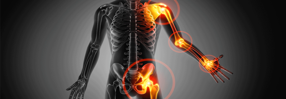 In einer Untersuchung haben Forscher mittels Patch-Test die allergische Reaktion auf 30 gängige Kontaktallergene sowie 40 weitere Substanzen untersucht, die häufig in der Zahnmedizin verwendet werden. 