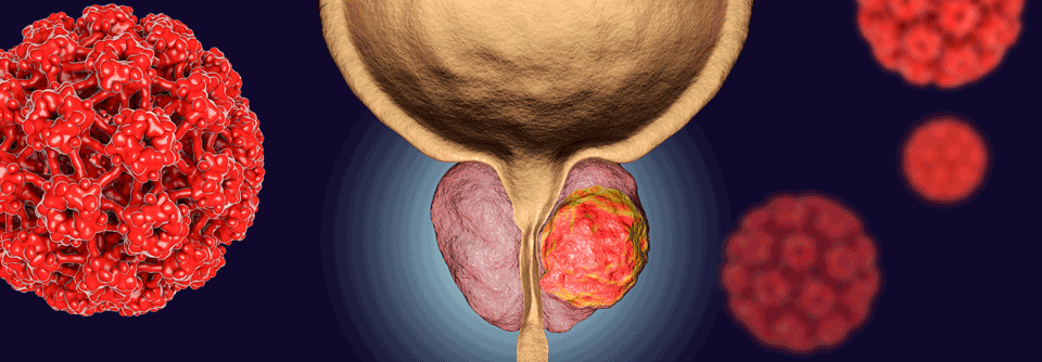 Wissenschaftler:innen untersuchten einen Androgenrezeptor-Inhibitor mit verminderter Fähigkeit, die Blut-Hirn-Schranke zu penetrieren.