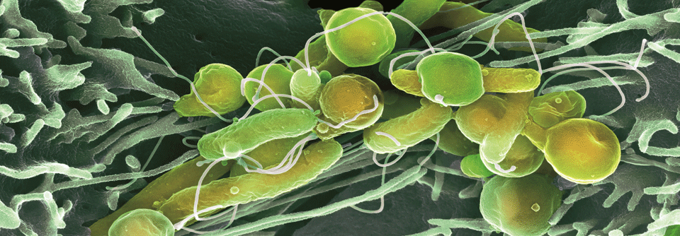 Im Rasterelektronenmikroskop erkennt man das gramnegative Stäbchenbakterium in der Schleimhaut gut.