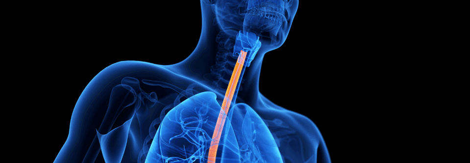 Laut Ergebnisse einer dänischen Studie, nimmt die Anzahl der Erkrankung eosinophile Ösophagitis weiter zu.