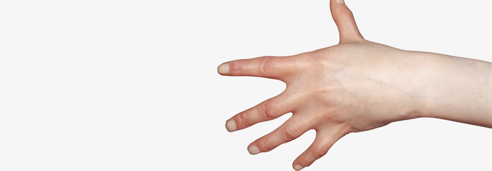 Klinefelter-Patienten haben oft große Hände.