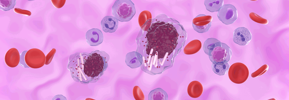 Die BAAG-Studie belegt, dass die Dreierkombination gegen CLL im Vergleich zu der gängigen Zweierkombinationen nicht überzeugt.