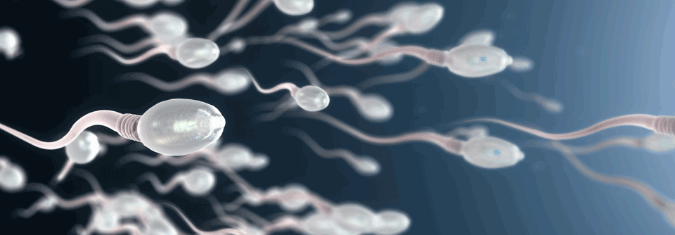 Eine Arbeitsgruppe bearbeitet die Fragestellung, ob es einen Unterschied macht, Spermien von Männern vor oder nach einer Ablatio testis zu kryo­konservieren.