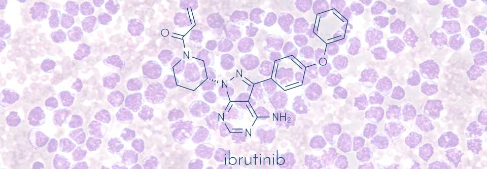 Die SHINE-Studie konnte zeigen, dass Patient:innen mit Mantelzell-Lymphom bei zusätzlicher Gabe von Ibrutinib, neben Bendamustin-Rituximab, durschnittlich zwei Jahre länger progressionsfrei bleiben.