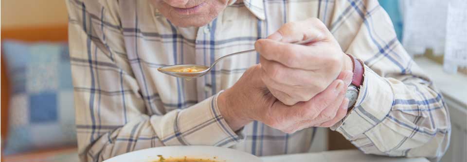 Eine Längsschnittstudie konnte zeigen, dass Parkinson-Patienten rascher kognitiv abbauen, wenn sie ihr Gewicht reduzieren. 