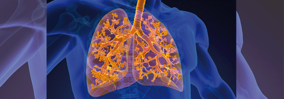 Aktuelle Untersuchungen zeigen, dass solche Pfropfen beim schweren Asthma gehäuft vorkommen, wahrscheinlich weil die Peroxidase der Eosinophilen den Mukus verändert, sodass er dicker und fester wird. 