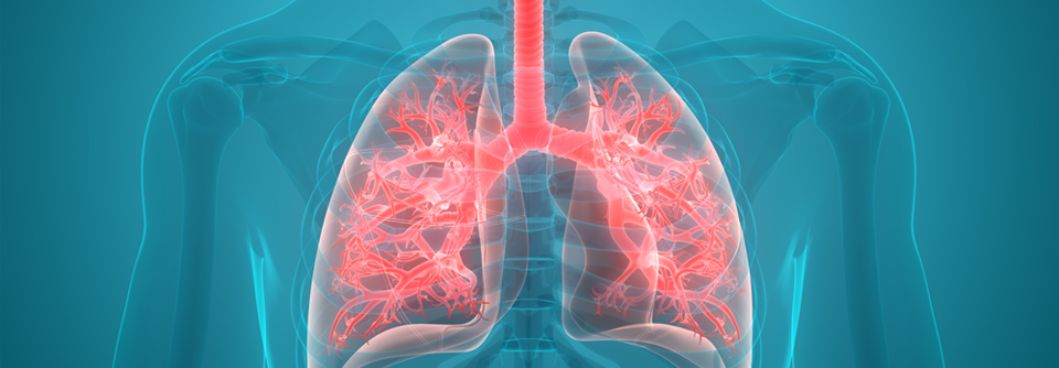 Der Verdacht auf eine pulmonale Nebenwirkung leitet sich aus dem zeitlichen Zusammenhang zwischen Exposition und klinischer Symptomatik ab.