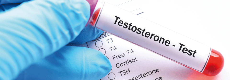 Es gilt, einen möglichen Einfluss der Testosteronsubstitution auf Erythropoese und Prostatawachstum rechtzeitig zu erkennen.