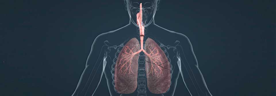 Viele Atemwegskrankheiten haben eine inflammatorische Basis gemein, mit dem Antikörper Dupilumab (Dupixent®) kann gegen die systemischen Entzündungen vorgegangen werden.