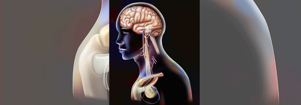 Den Wissenschaftlern gelang es nun erstmals, die Magen-Hirn-Kopplung von außen gezielt zu beeinflussen.
