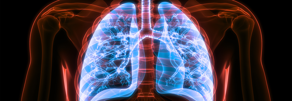 Bereits 1-2 Hospitalisierungen aufgrund einer akuten COPD-Exazerbation können zu einem Mortalitätsrisiko von 55 Prozent innerhalb von fünf Jahren führen.