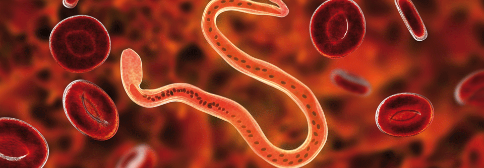 Auch das Katayama-Syndrom als frühe und akute Phase einer Schis­tosomiasis kann mit Juckreiz einhergehen. 