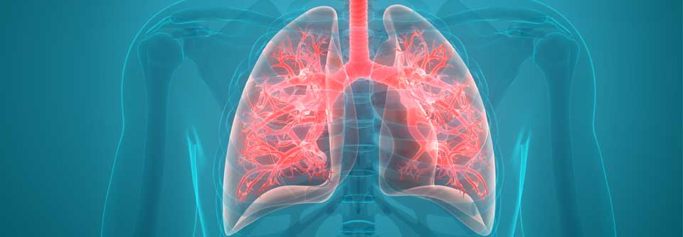 Die Takayasu-Arteriitis kann auch die Lunge treffen.