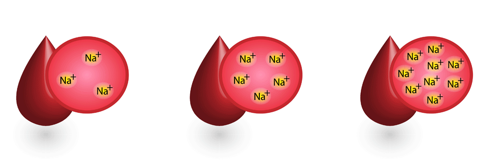 Die beiden Ärzte gaben ihrem Patienten die Empfehlung, künftig nur noch Wasser mit ausreichend hohem Mineralgehalt zu trinken.