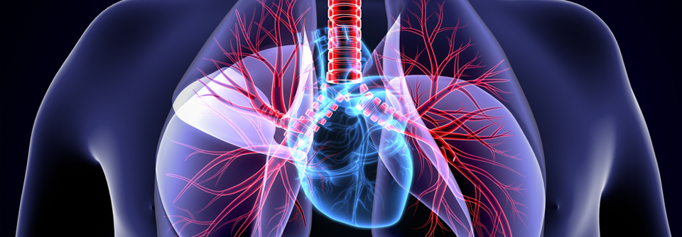 Der pulmonal-vaskuläre Widerstand ist um knapp 3 WU und der pulmonal-arterielle Druck um knapp 14 mmHg abgefallen.