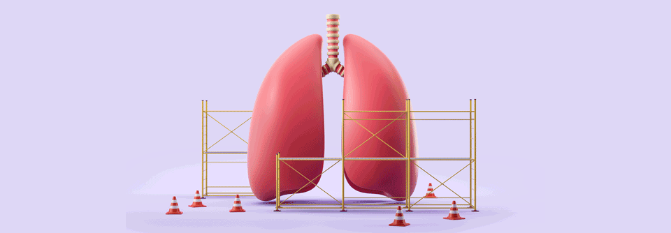 Durch die zusätzliche Gabe von neoadjuvantem Nivolumab zur Chemotherapie verlängerte sich das ereignisfreie Überleben von NSCLC Patient:innen.
