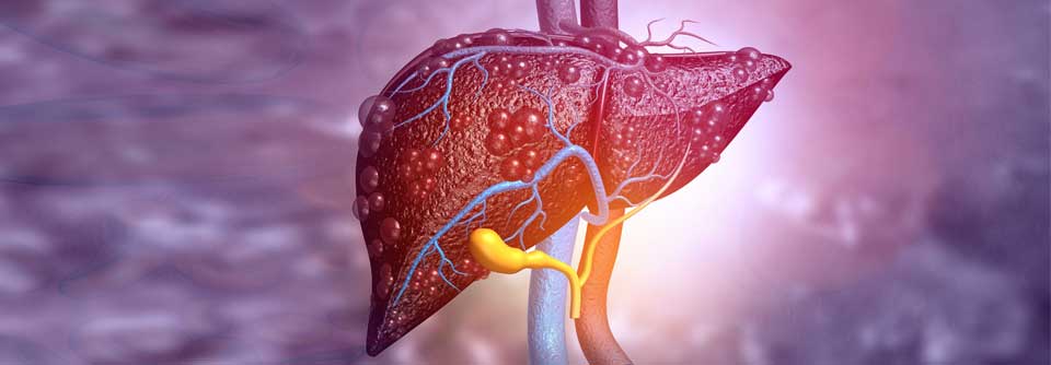 Autoimmunhepatitis: Wenn der Körper die eigene Leber bekämpft Da sich die Diagnose der Autoimmunhepatitis als schwierig erweist, gilt es meist, andere Ursachen für Leberprobleme auszuschließen.