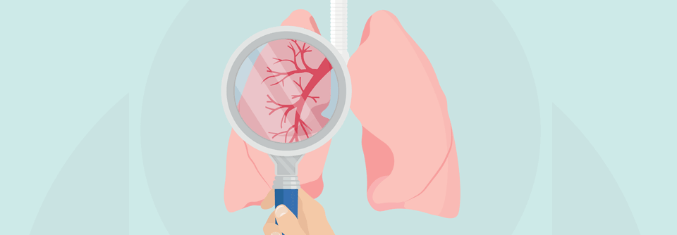 Wenige NSCLC Patient:innen weisen ROS1- und NTRK-Mutationen auf.