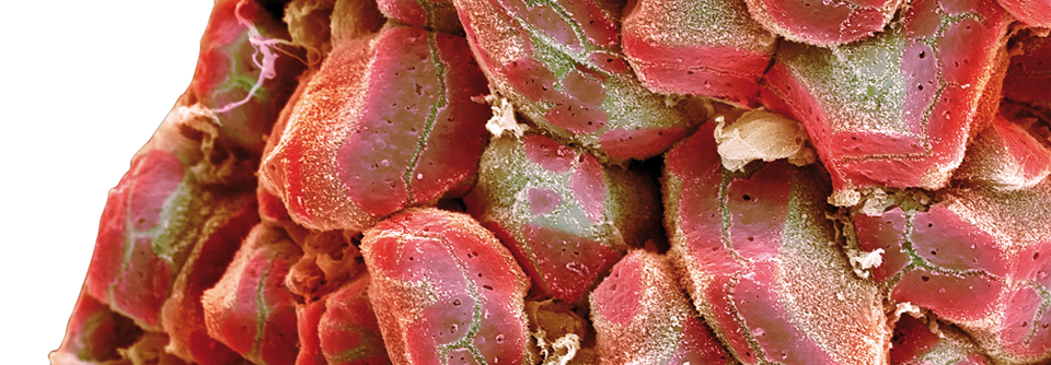 Leberzellen am Rand des Organs, ohne Gefäße und Bindegewebe (kolorierte elektronenmikroskopische Aufnahme).
