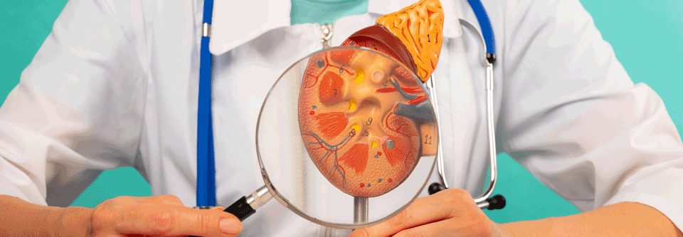 Patient:innen mit Multiplem Myelom weisen oft zum Zeitpunkt der Diagnose eine Nierenfunktionsstörung auf. Auf was sollte im Zuge der Therapie besonders geachtet werden?