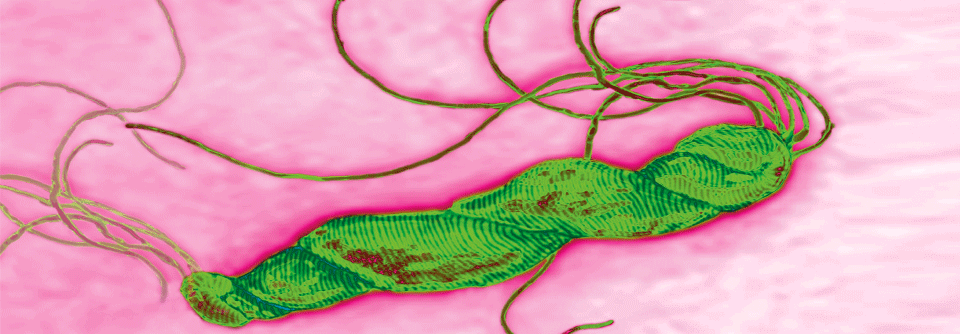 Durch Eradikation von H. pylori lassen sich Rezidive gastraler und duodenaler Ulzera verhindern.