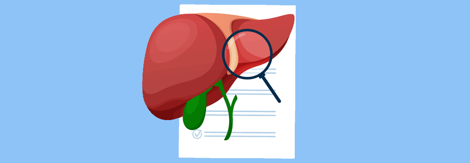 Zusätzliches Pembrolizumab konnte die Ergebnisse bei der Behandlung eines fortgeschrittenen Cholangiokarzinoms verbessern. 