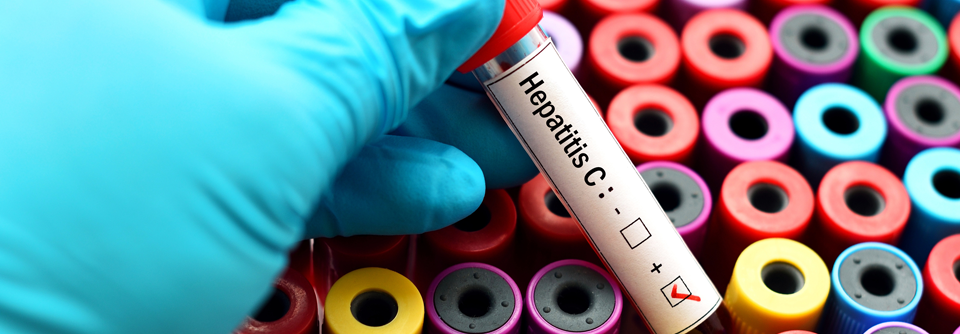 DAAs könnten dazu führen, dass bis 2030 die Hepatitis C eradiziert wird.