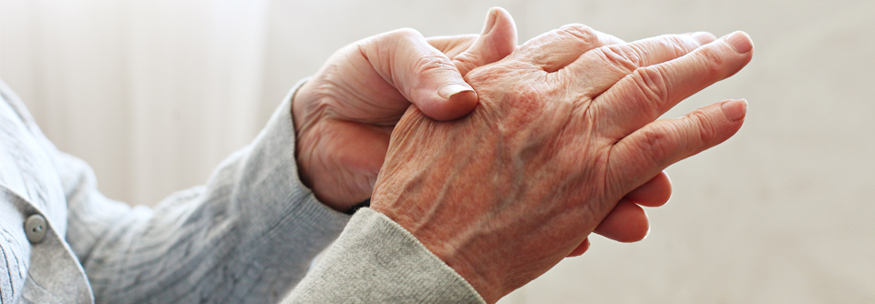 Erosive Handarthrose: Eine Frage der Gene Drei Genloci werden mit der EHOA assoziiert.