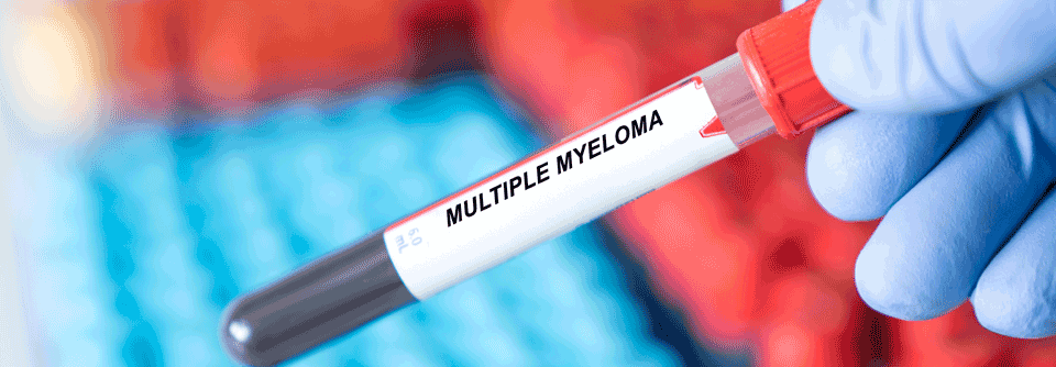 Die Behandlung des Multiplen Myeloms befindet sich aktuell im Wandel.
